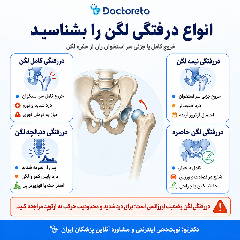اینفوگرافی در رفتگی لگن
