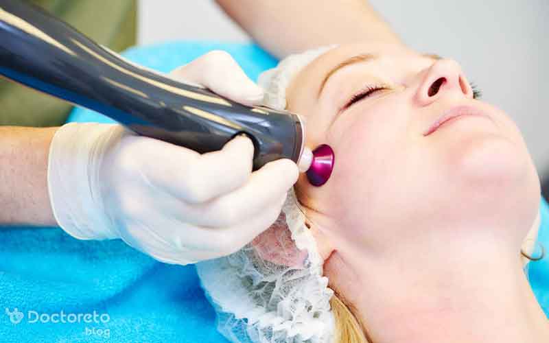 نحوه برداشتن خال با لیزر چگونه است؟