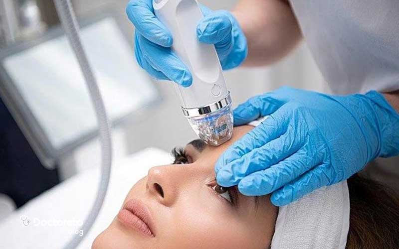 تفاوت روش انجام آر اف با میکرونیدلینگ در چیست؟
