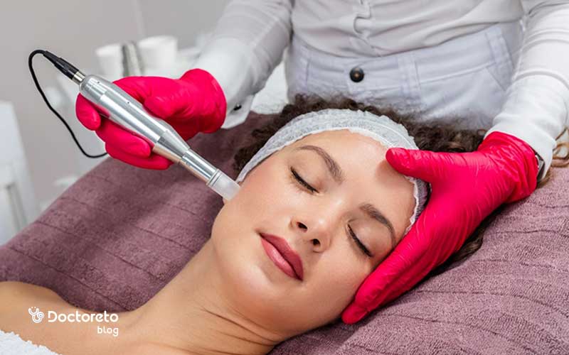 کاربردهای میکرونیدلینگ برای لک صورت چیست؟