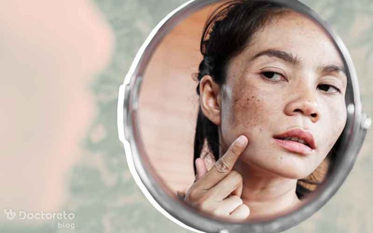رفع لک صورت با چه روش هایی امکانپذیر است؟