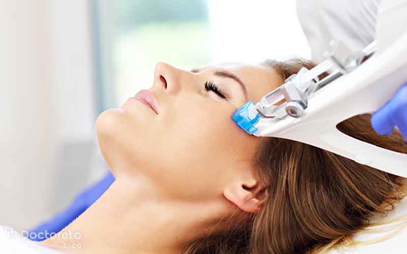 کربوکسی تراپی در فیشیال برای چه کسانی مناسب نیست؟