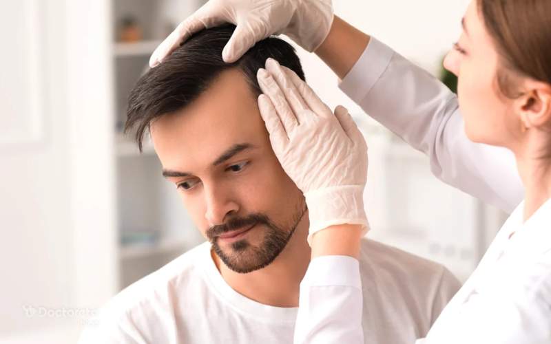 بعد از کاشت مو چی بخوریم؟