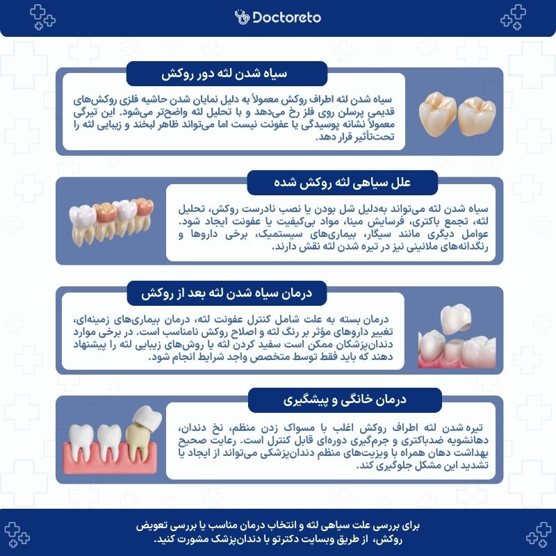 اینفوگرافی سیاه شدن لثه دندان روکش شده