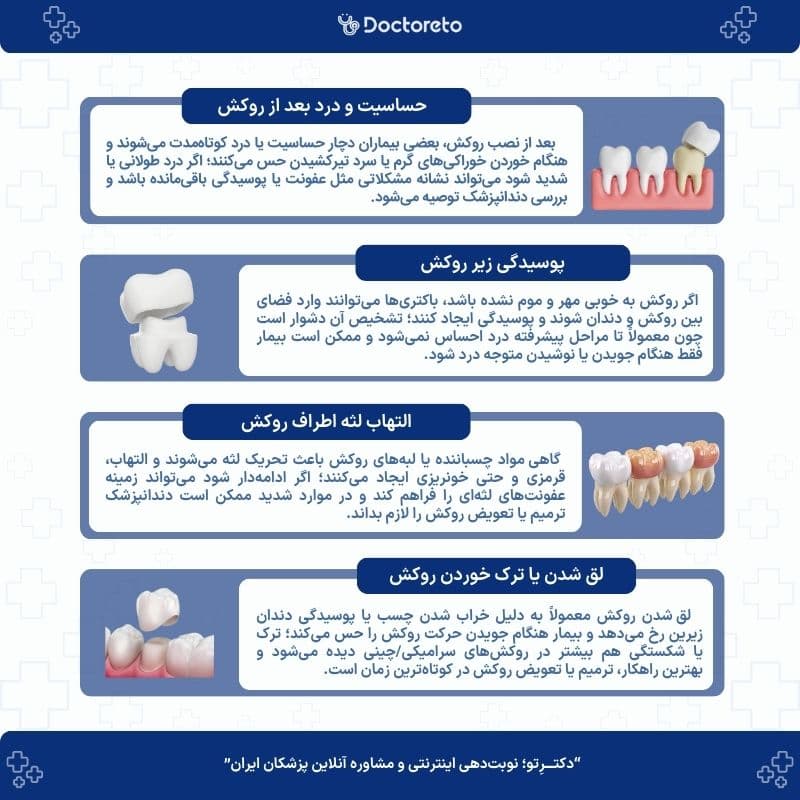 اینفوگرافی عوارض روکش دندان