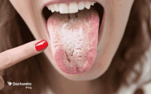 چه بیماری هایی باعث خشکی دهان میشود؟