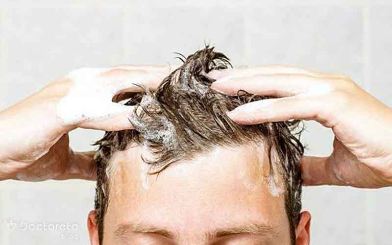 بهترین شامپو بعد از کاشت مو چیست؟