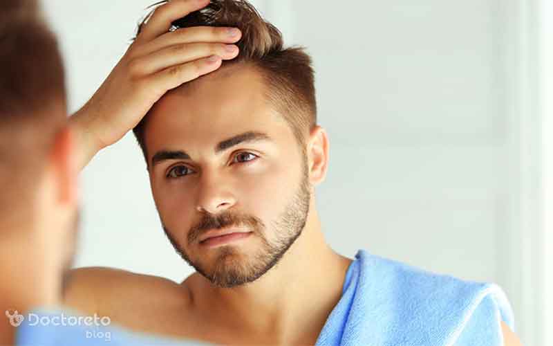 کاشت مو بدون تراشیدن سر چیست؟