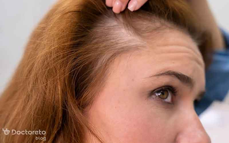 به منظور اثربخشی کاشت مو باید مراقبت ها به درستی رعایت شود.