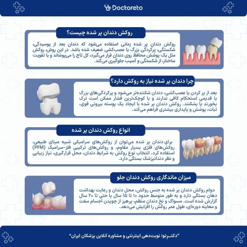 اینفوگرافی روکش دندان پر شده