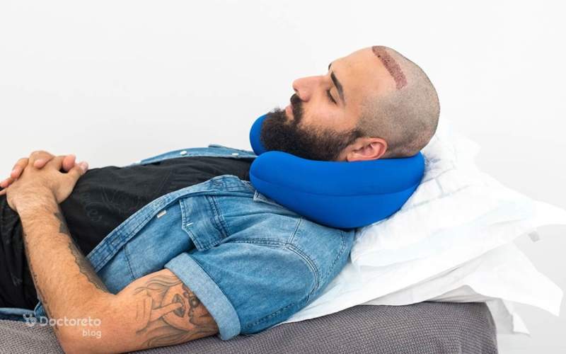 نحوه خوابیدن بعد از کاشت مو چگونه باید باشد؟