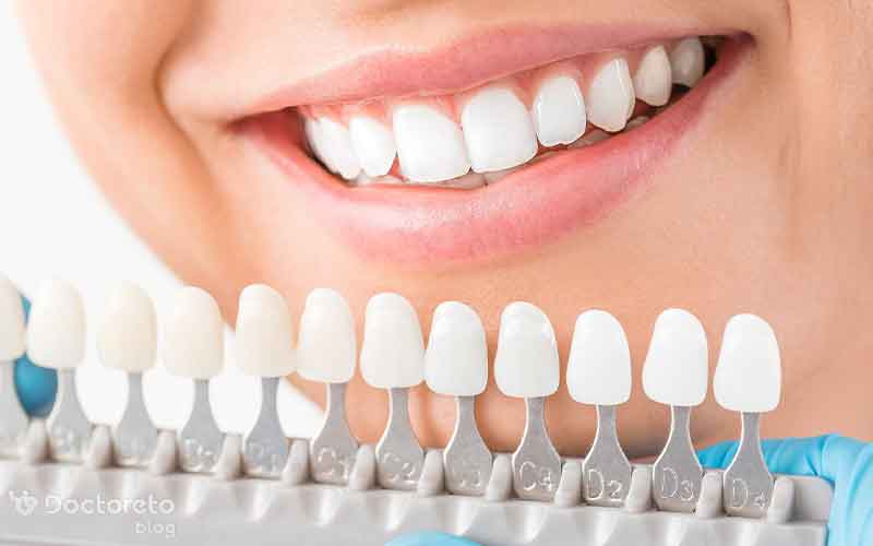 فاصله بین عصب کشی و روکش دندان چقدر است؟