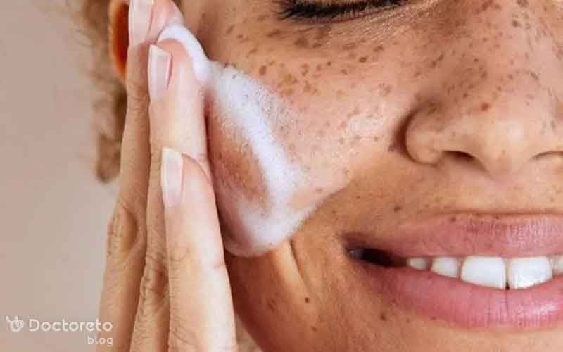 بهترین کرم برای لک قهوه ای صورت چیست؟
