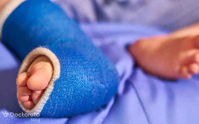 بررسی انواع روش های درمان پای پرانتزی