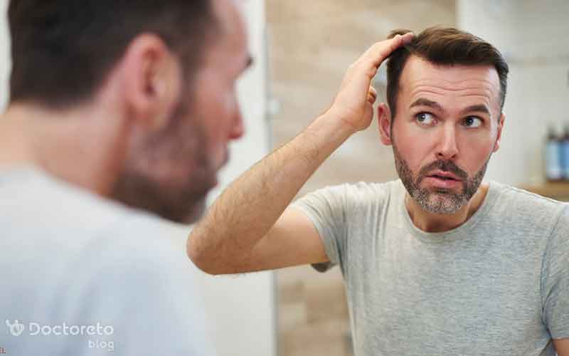 جدیدترین روش کاشت مو چیست؟