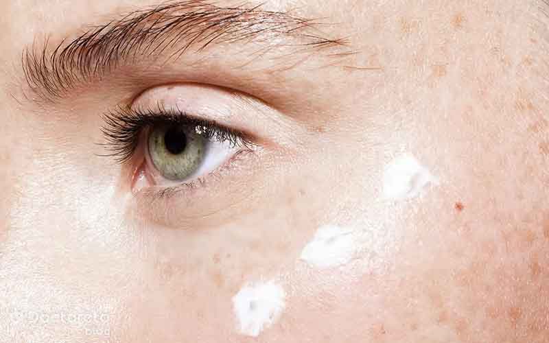 از بین بردن لک صورت در خانه چگونه است؟