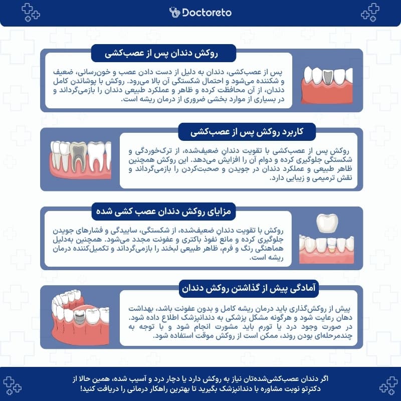اینفوگرافی روکش دندان عصب کشی شده