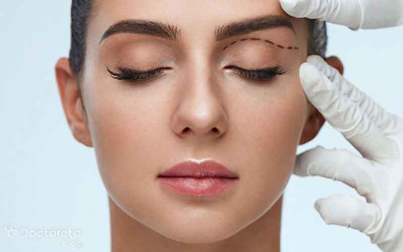 بلفاروپلاستی با لیزر چیست؟