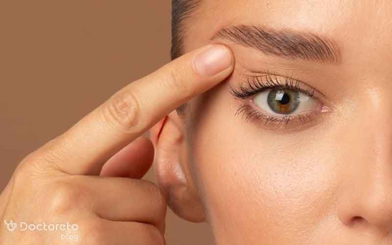 بلفاروپلاستی چشم گربه ای چیست؟