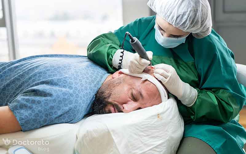 احتمال مرگ در اثر کاشت مو چقدر است؟