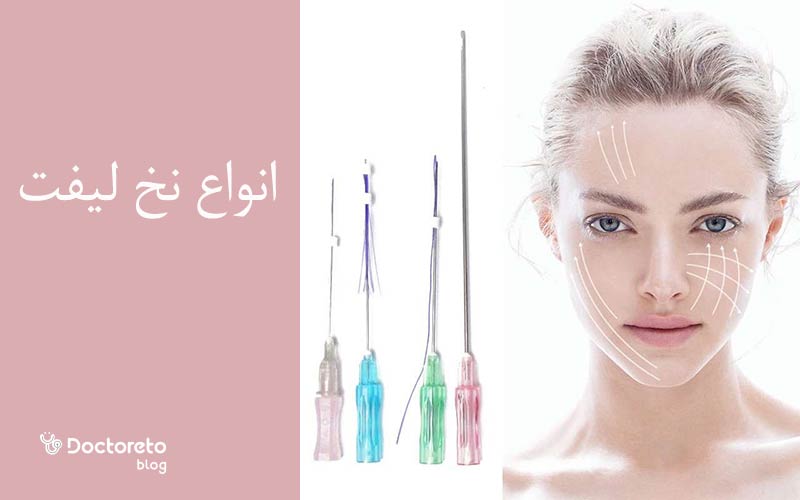انواع نخ لیفت صورت بر اساس جنس وجود دارد.