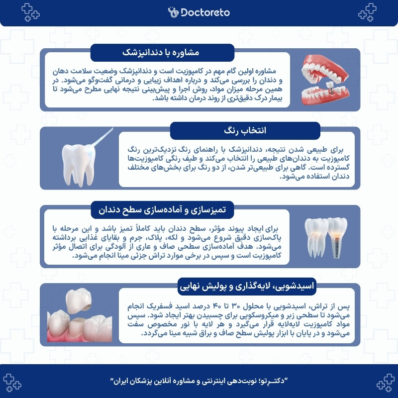 اینفوگرافی مراجل کامپوزیت دندان