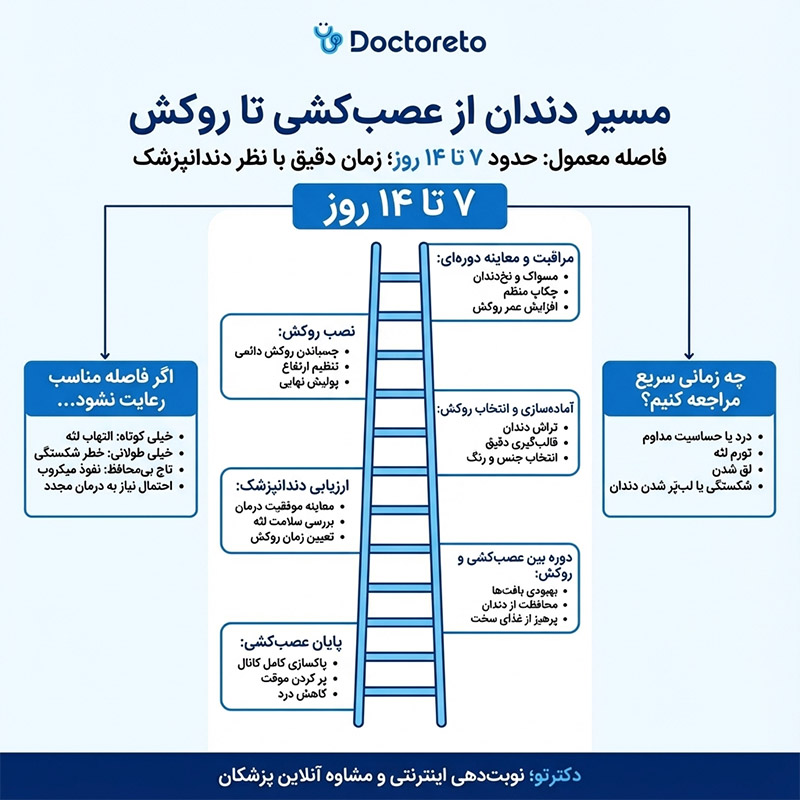 اینفوگرافی همه چیز درباره فاصله بین عصب کشی و روکش دندان