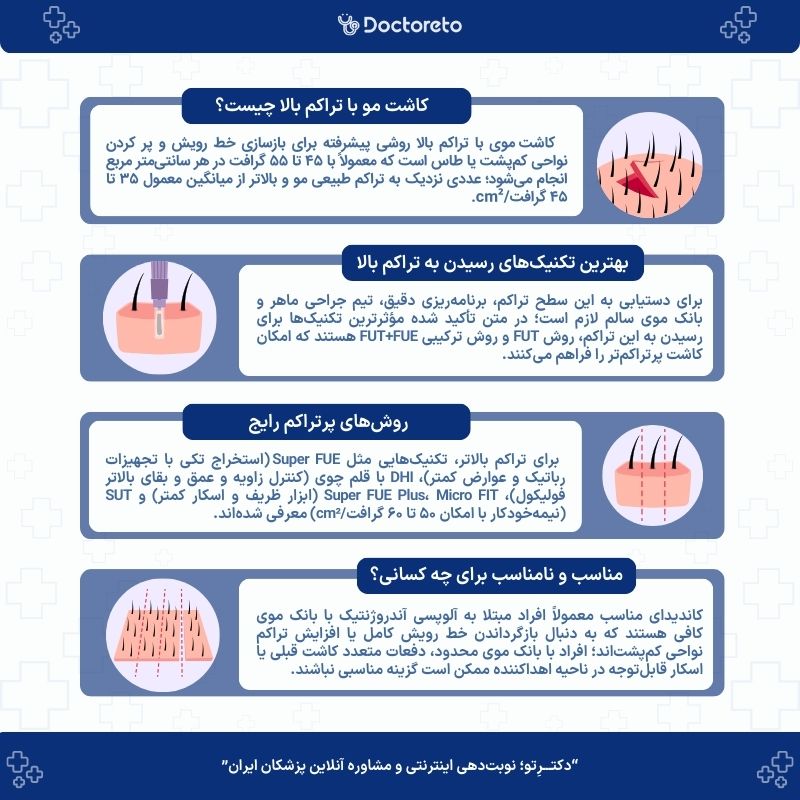 اینفوگرافی کاشت مو با تراکم بالا