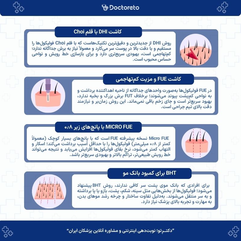 اینفوگرافی کاشت مو به روش DHI