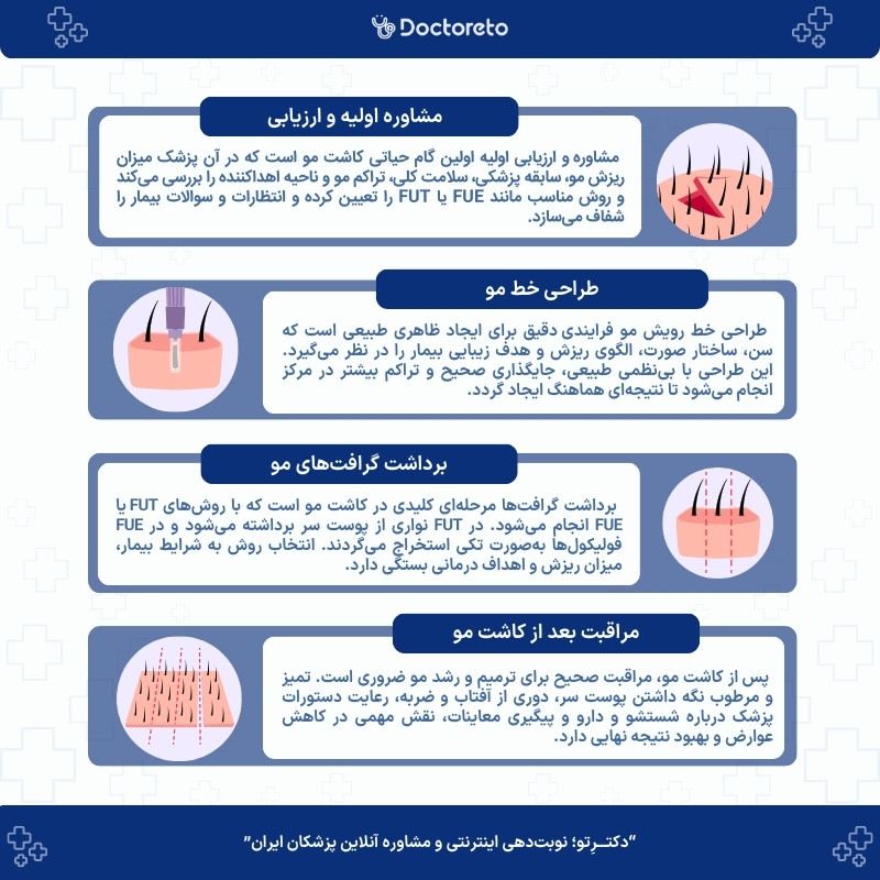 اینفوگرافی مراحل کاشت مو