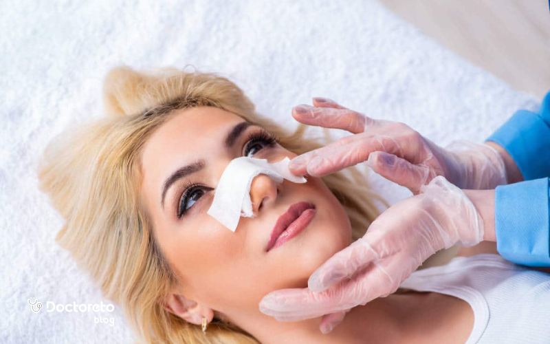 تا چند روز بعد عمل بینی باید سربالا باشد؟