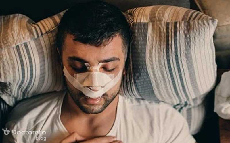 عکس نحوه خوابیدن بعد از عمل بینی چگونه است؟