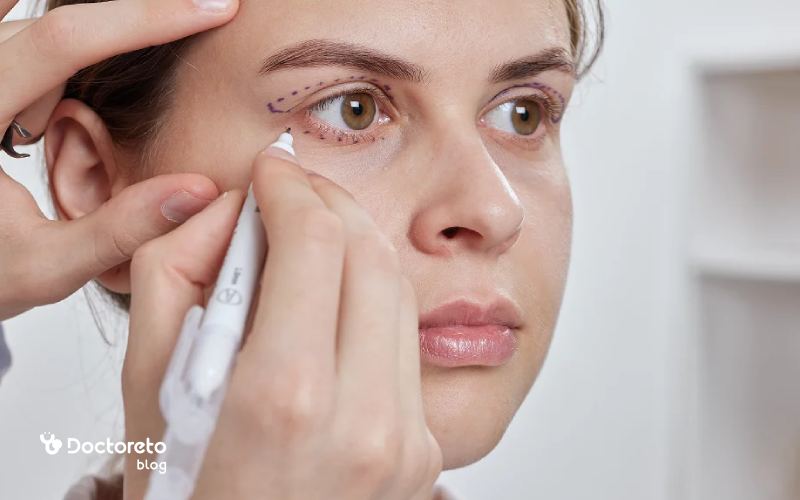 جای بخیه بلفاروپلاستی کی از بین می رود؟