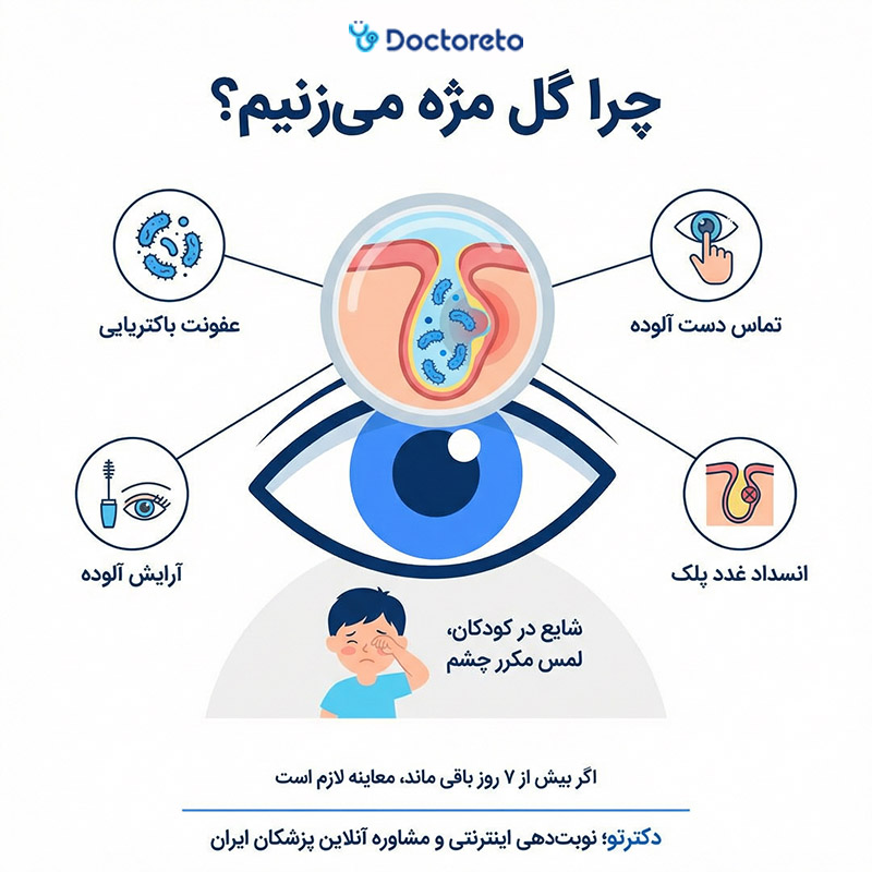 اینفوگرافیک علت گل مژه
