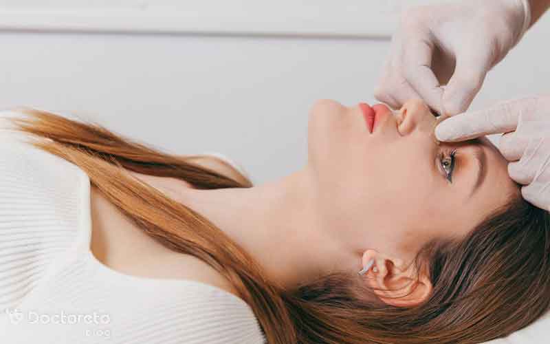 چسب بینی بعد از عمل را چگونه استفاده کنیم؟