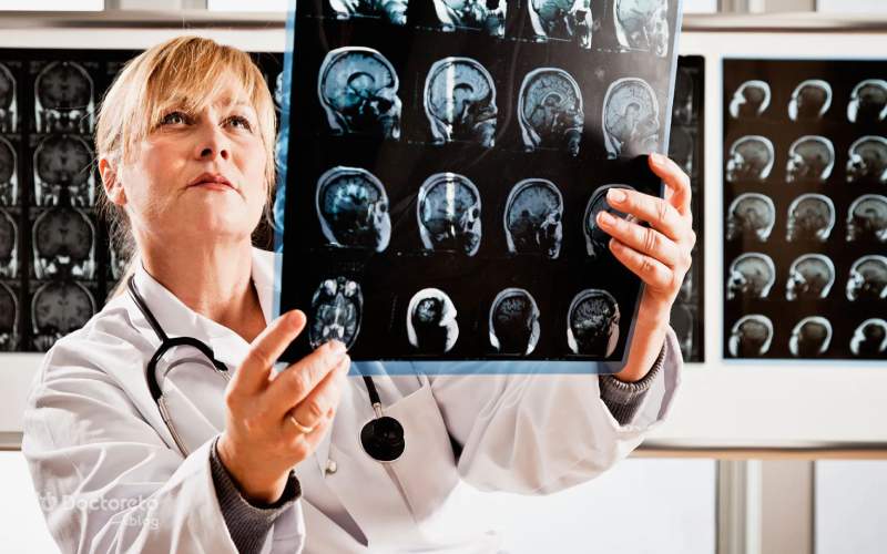 زمان بروز علائم خونریزی مغزی ناشی از ضربه کی است؟