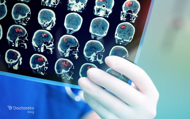 علائم خطرناک و اورژانسی خونریزی مغزی بعد از ضربه چیست؟