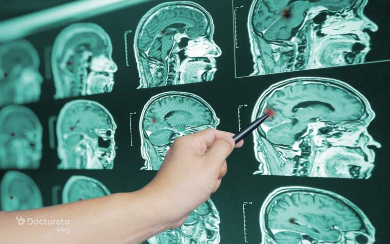 علائم خونریزی مغزی ناشی از ضربه چیست؟