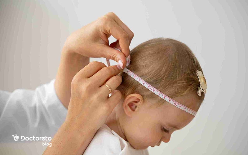 میکروسفالی خفیف چیست؟
