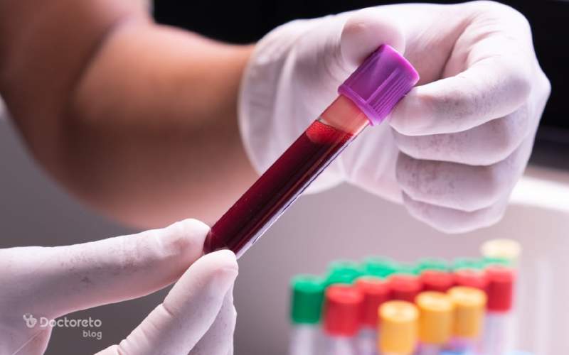 آزمایش پتاسیم خون نشان دهنده چیست؟