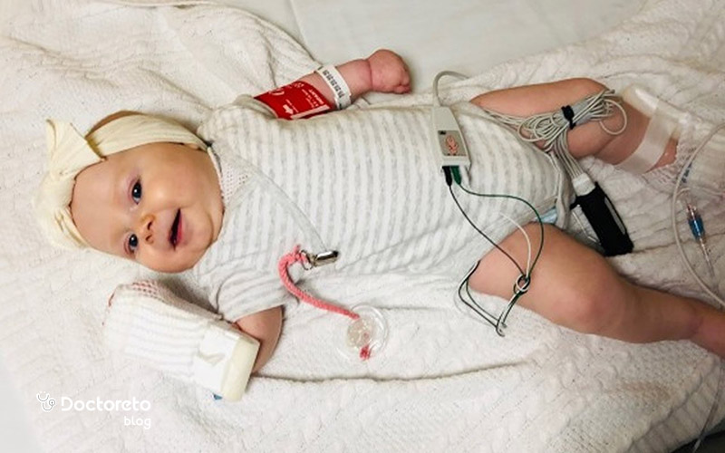 درمان پزشکی بیماری اس ام ای چیست؟