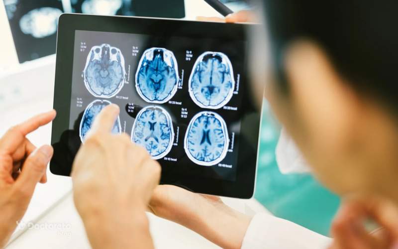 مرکز سر نیز از مراکز حساس برای ضربه است.