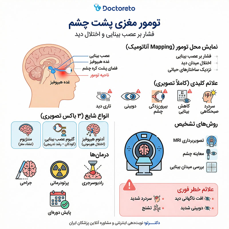 اینفوگرافیک تومور مغزی پشت چشم