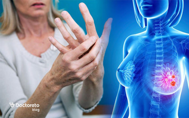 درد دست بعد از عمل سرطان سینه یکی از عوارض آن است.