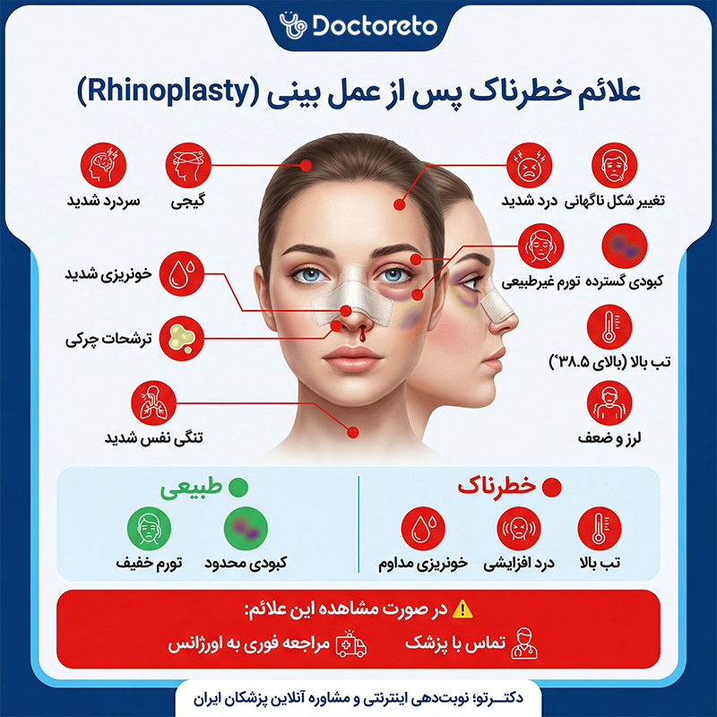 اینفوگرافی علائم خطرناک بعد از عمل بینی
