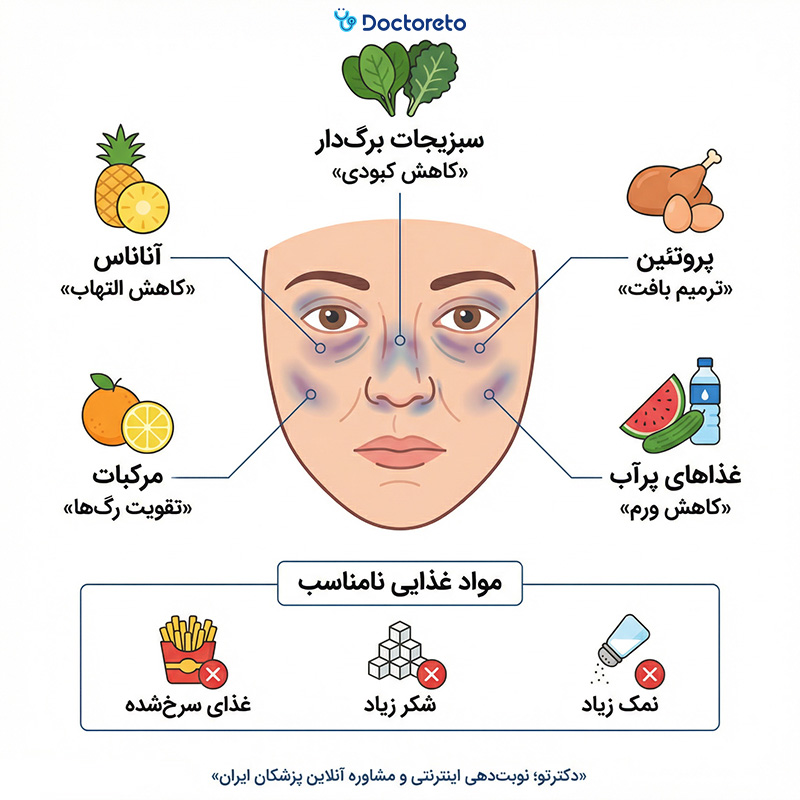 اینفوگرافی برای رفع کبودی بعد از عمل بینی چه بخوریم