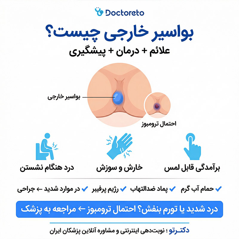 اینفوگرافیک بواسیر خارجی