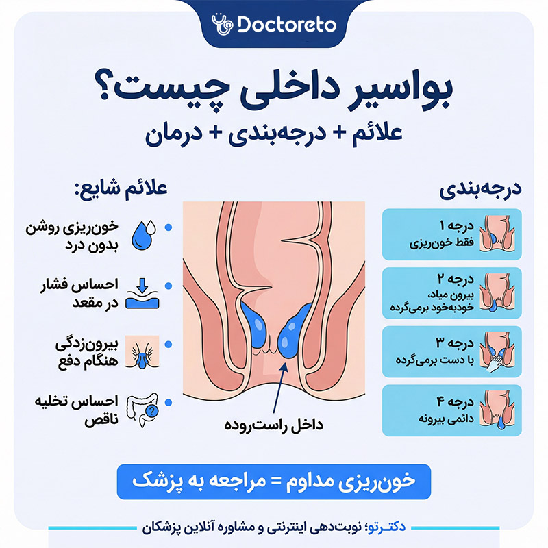 اینفوگرافیک بواسیر داخلی