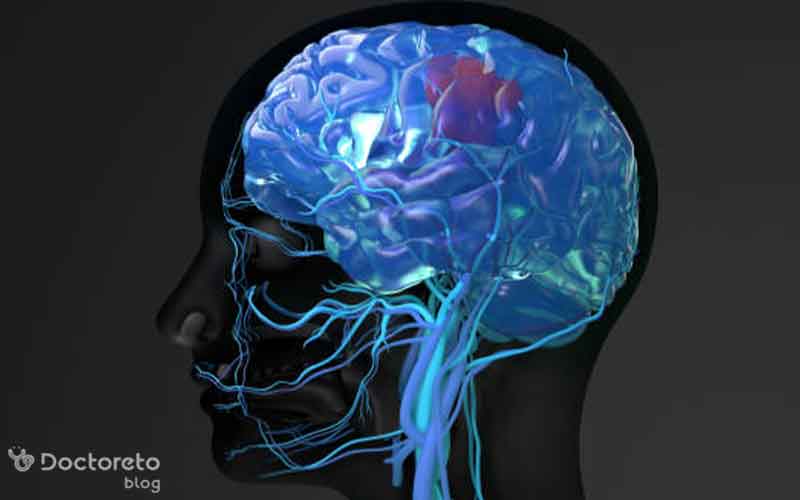 تحریک الکتریکی مغز چگونه انجام می شود؟