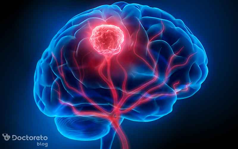 تومور مغزی پشت چشم چیست؟